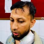 ডাকাত দলের হামলার শিকার মুরাদনগরের এসিল্যান্ড সাকিব হাছান - Chief TV