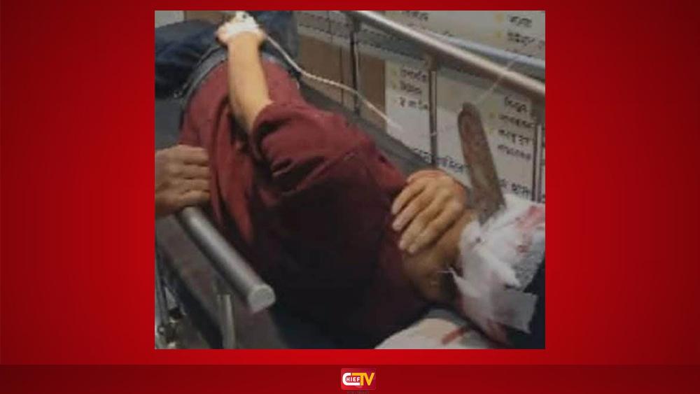 জাবিতে ঘাস কাটা মেশিনের ব্লেড ভেঙে ঢুকল যুবকের মাথায়