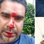গাইবান্ধায় সিম মেলায় চাঁদা দাবির অভিযোগ, সাকিল নামের সুপারভাইজারকে পিটিয়ে আহত।
