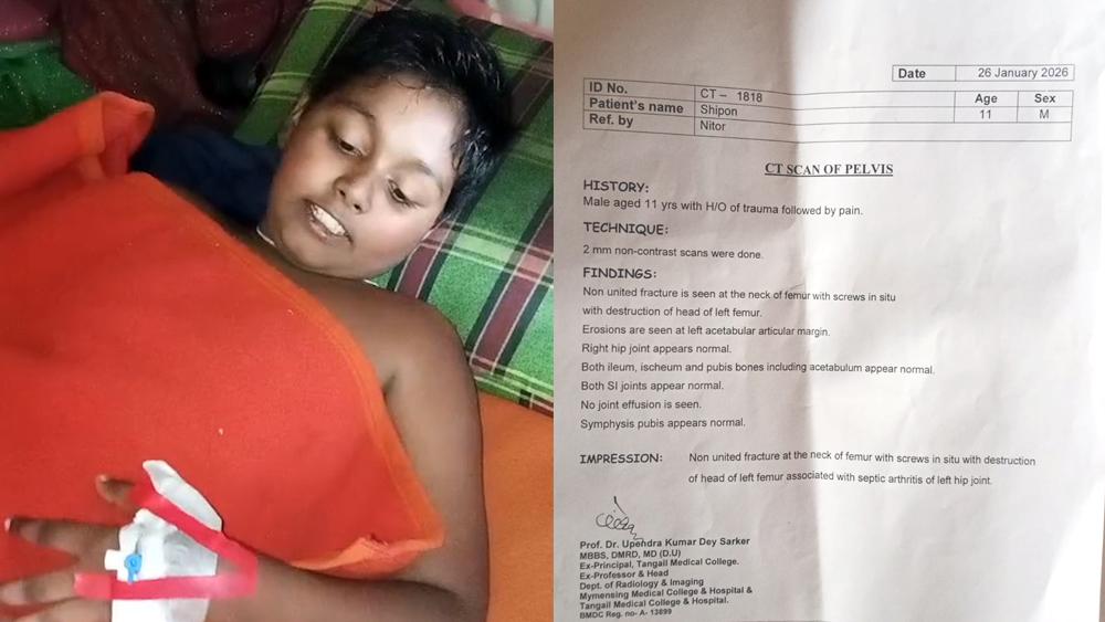 টাকার অভাবে থমকে গেছে শিপনের জীবন - পাশে দাঁড়াবার আহবান - Chief TV