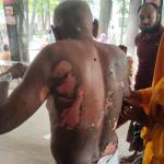 সৈয়দপুরে আগুনে ঝলসানো বৃদ্ধ উদ্ধার নাশকতার ঘটনায় পাল্টাপাল্টি অভিযোগ  -Chief TV