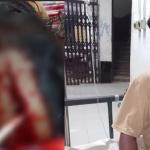 জাল চুরি ঠেকাতে গিয়ে মা-ছেলে আহত, থানায় মামলা - Chief TV